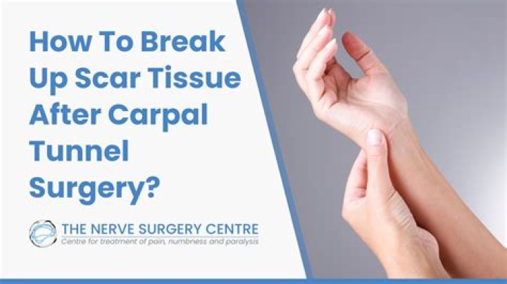 Do you get narcotics after carpal tunnel surgery?