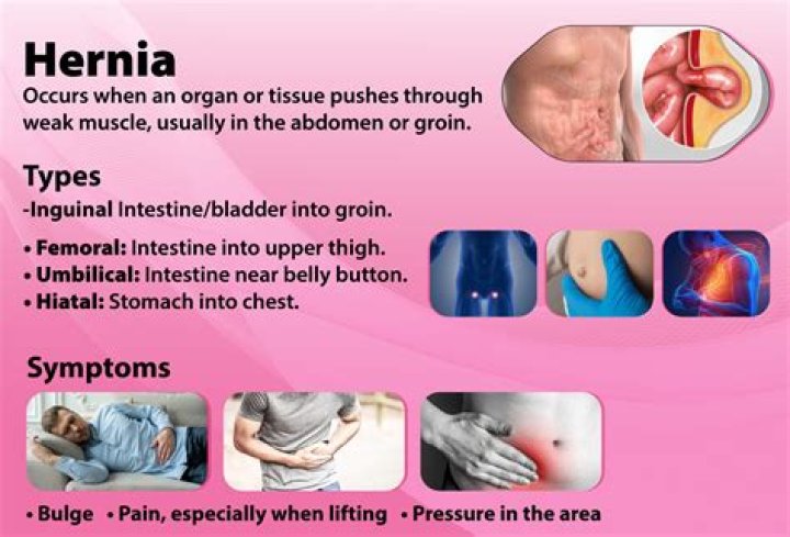 Does a hernia make you urinate more?