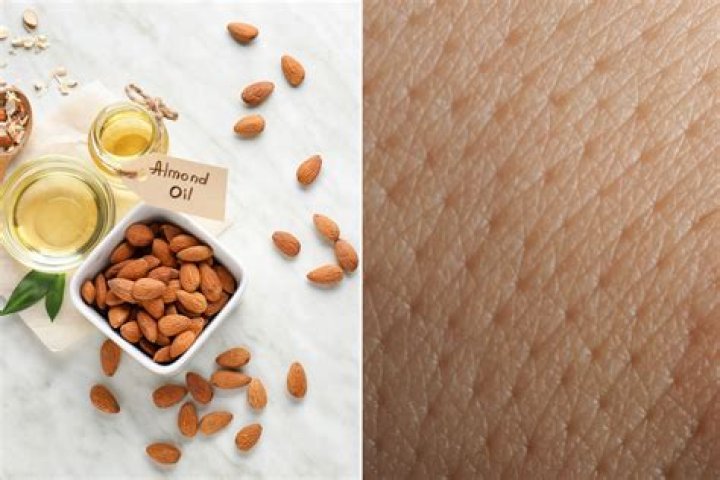 Does almond oil clog pores?