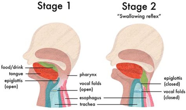 Does aphasia affect swallowing?
