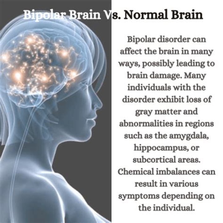Does bipolar damage the brain?