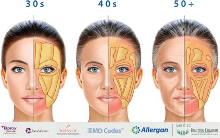 Does blowing balloons reduce face fat?