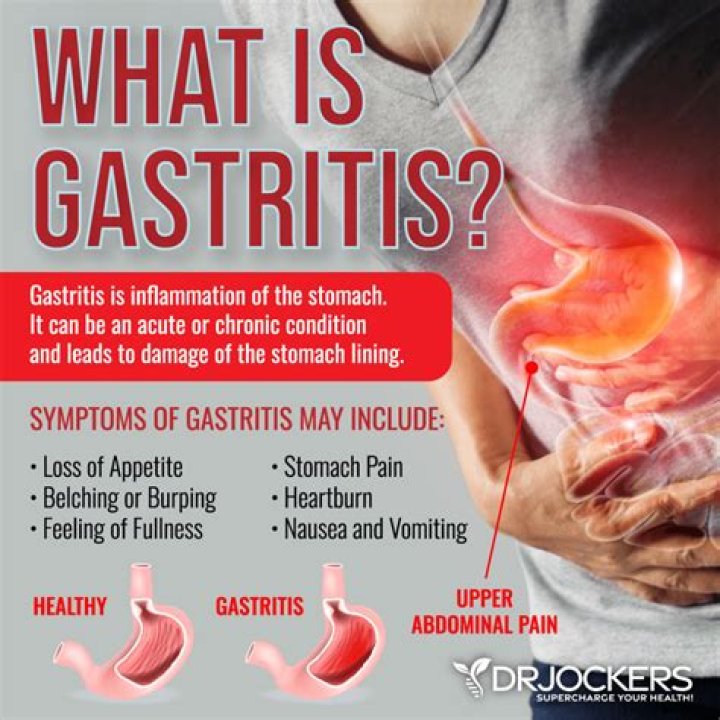 Does burping help gastritis?