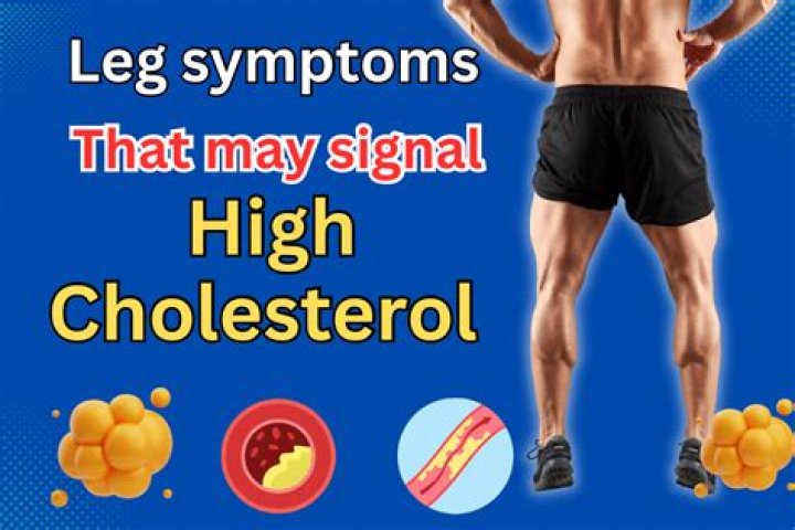 Does cholesterol cause leg pain?