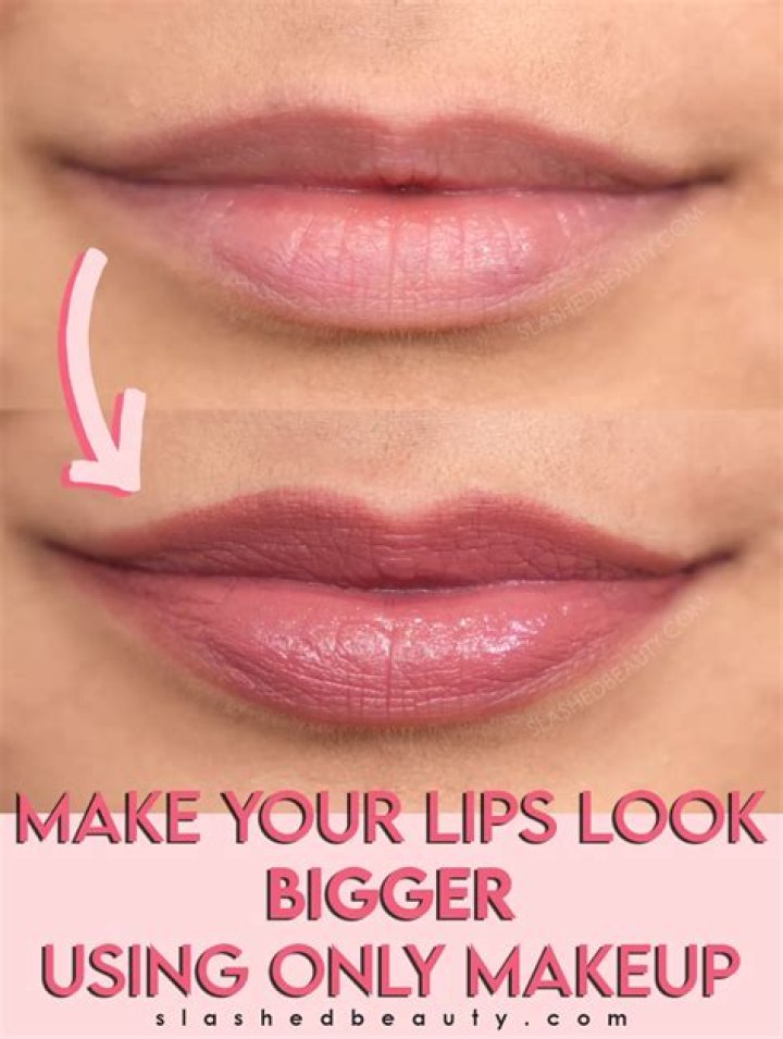 Does ice make your lips bigger or smaller?