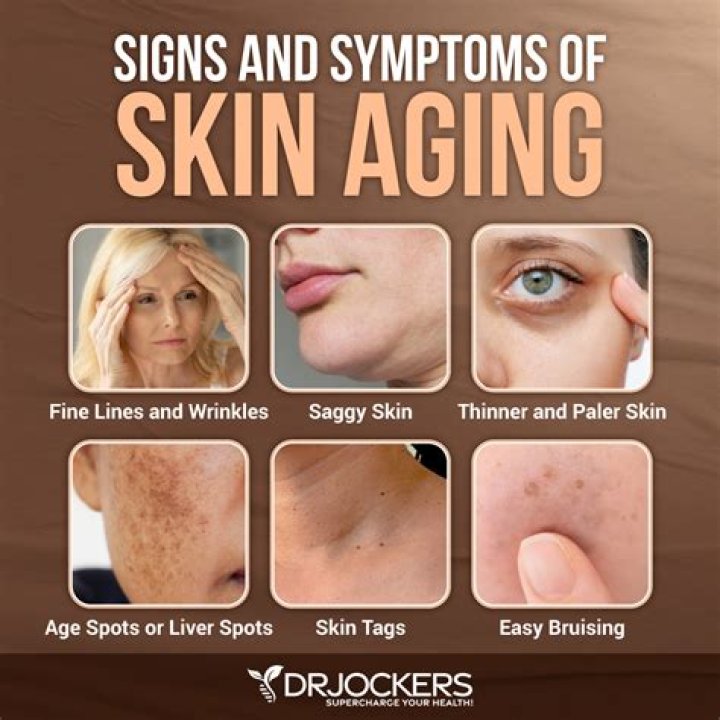 Does lack of protein cause saggy skin?