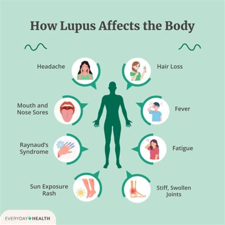 Does lupus make your back hurt?