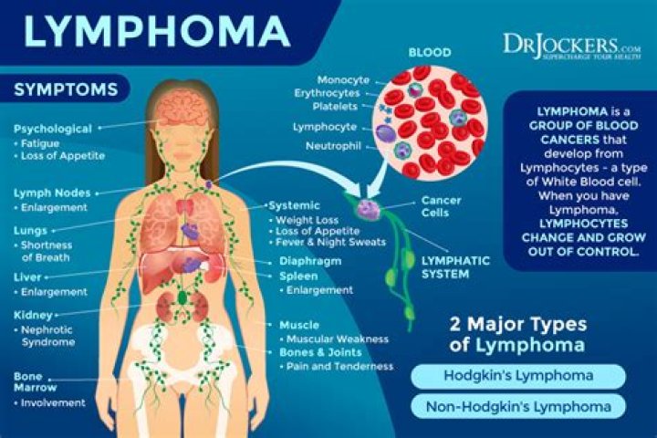 Does lymphoma cause weight gain?