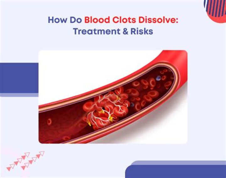 Does omega-3 dissolve blood clots?