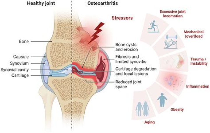 Does osteoarthritis reduce lifespan?