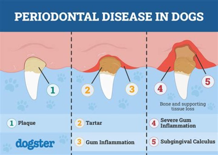 Does periodontal treatment hurt?