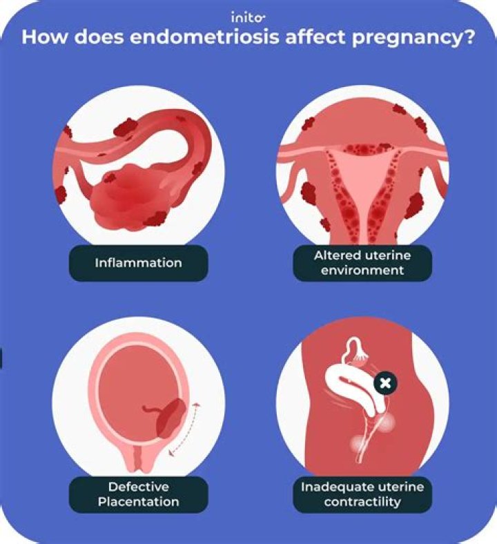 Does pregnancy make endometriosis worse?