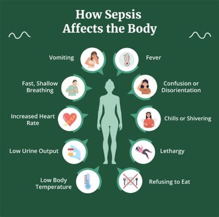 Does sepsis affect your mind?