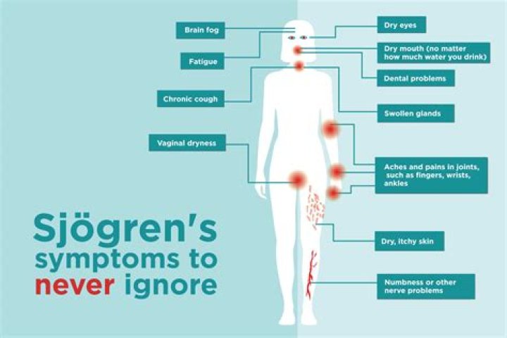 Does sjogrens cause nerve damage?