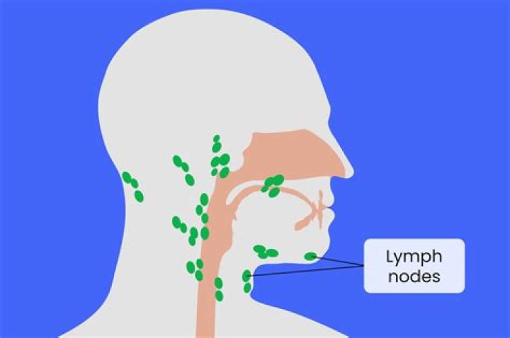 Does Sjögren's cause swollen lymph nodes?