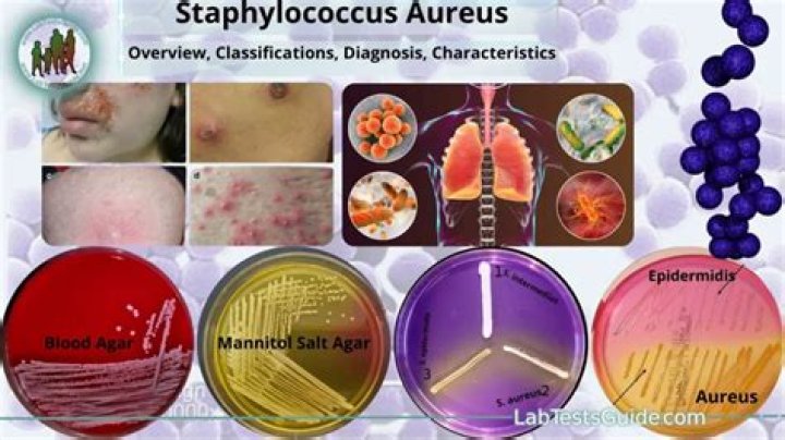 Does Staphylococcus cause discharge?