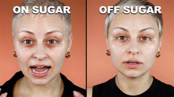 Does sugar make your face sag?