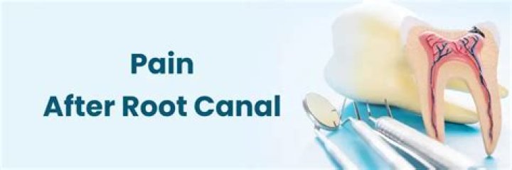 Does the dentist give you pain meds after a root canal?