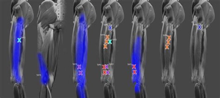 Has Trigger Point ended?