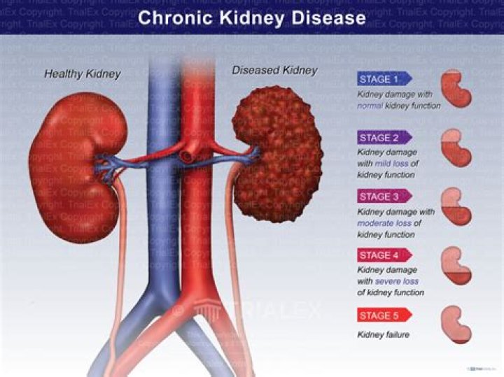 How can I check my kidneys at home?