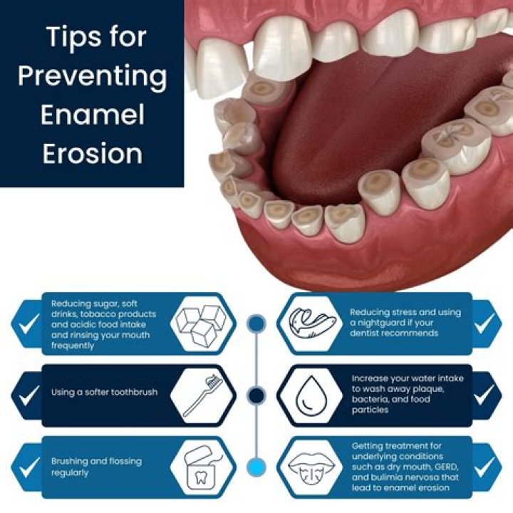 How can I hide my enamel loss?