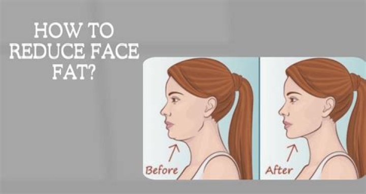 How can I lose face fat?