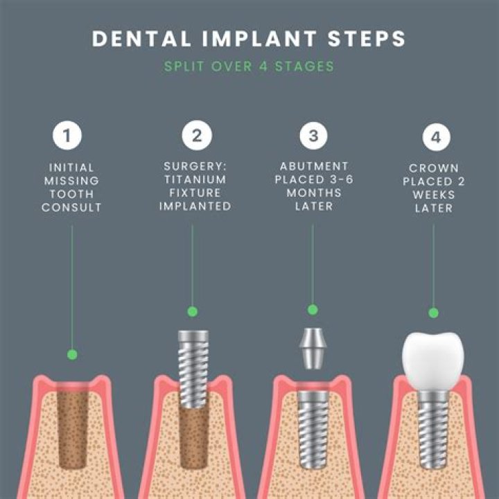 How can I make my dental implant heal faster?