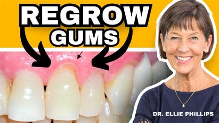 How can I regrow my gum bone naturally?