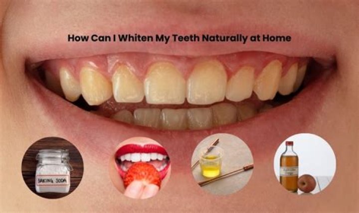 How can I whiten my teeth fast at home?