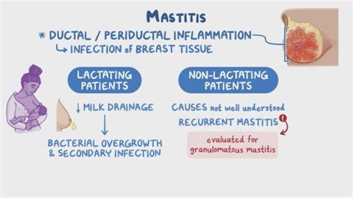 How can you tell the difference between mastitis and engorgement?