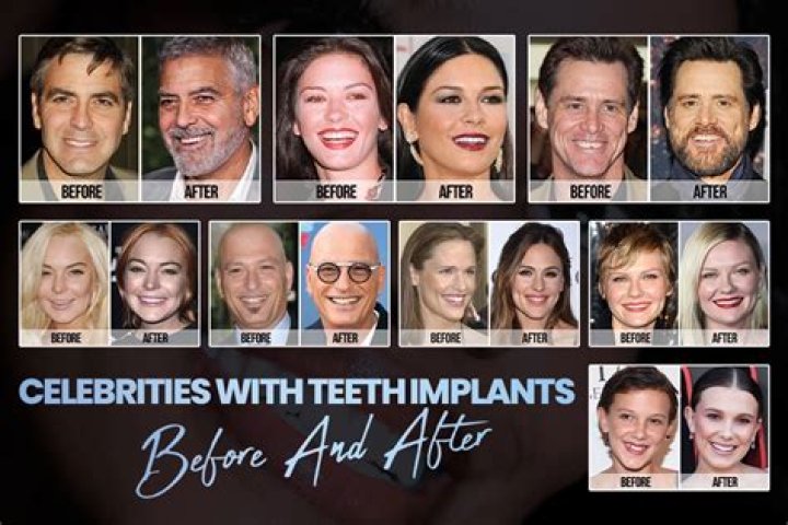 How do celebrities have great teeth?