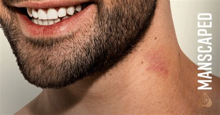 How do I get rid of my teenage girl mustache?