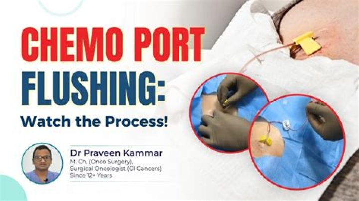 How do I keep my chemo port clean?