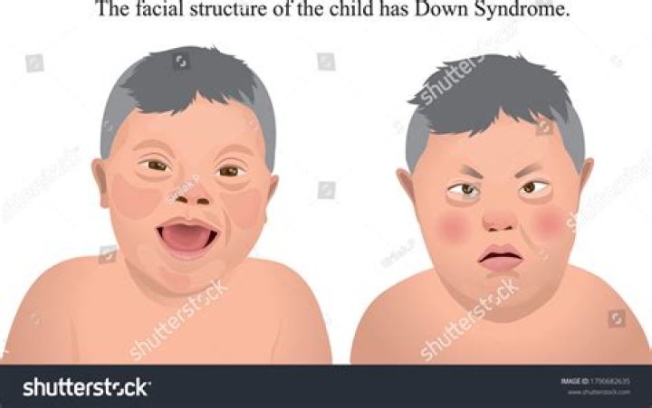 How do I know if my child has a low IQ?