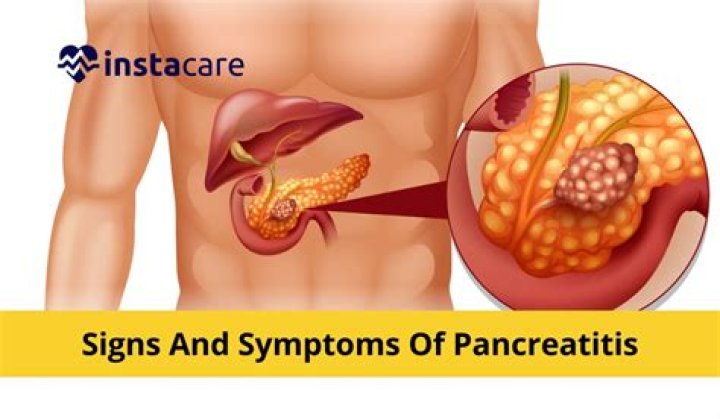 How do I know if my pain is pancreatitis?