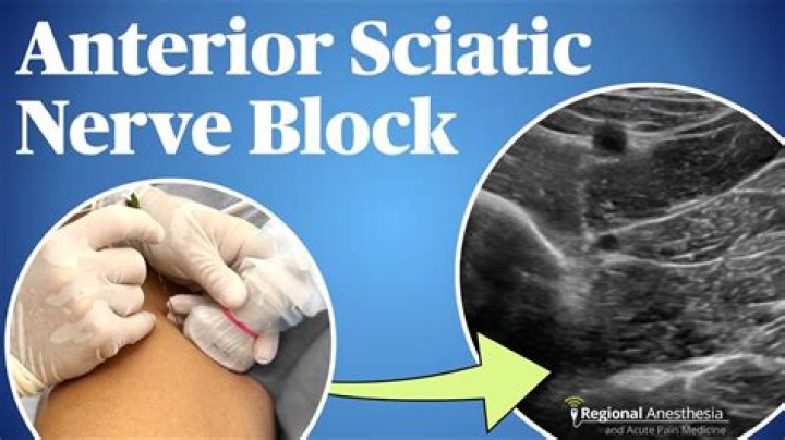 How do you block an ultrasound?