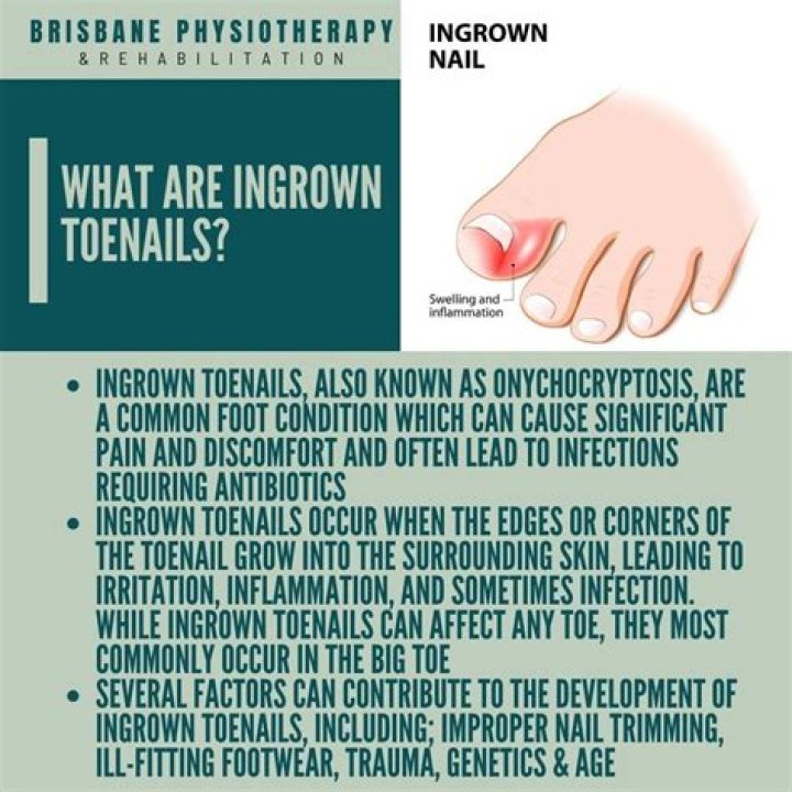 How do you deal with distant Aquarius?