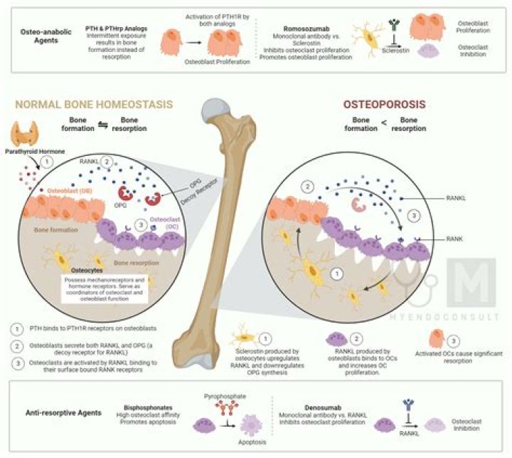 How do you detect osteonecrosis?