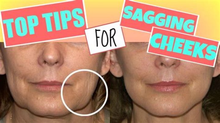 How do you fix saggy cheeks?