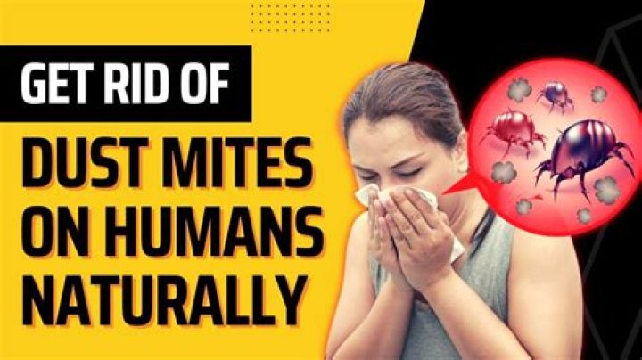 How do you get rid of mites on humans?