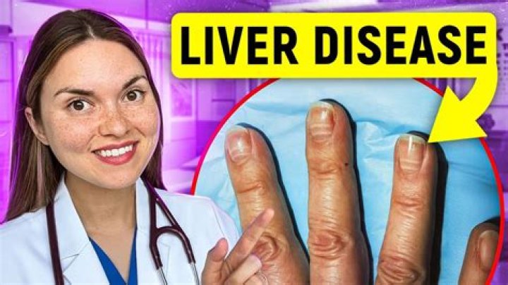 How do you know if your liver is not working properly?