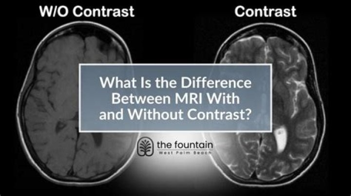 How do you prepare for an MRI with contrast?