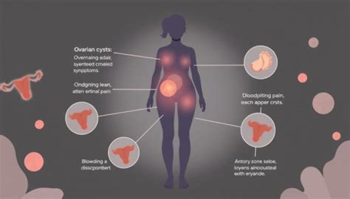 How do you prevent ovarian cysts?