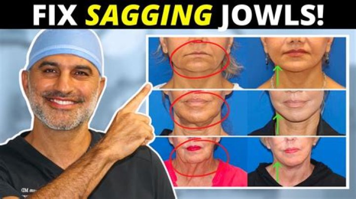 How do you reverse sagging jowls?