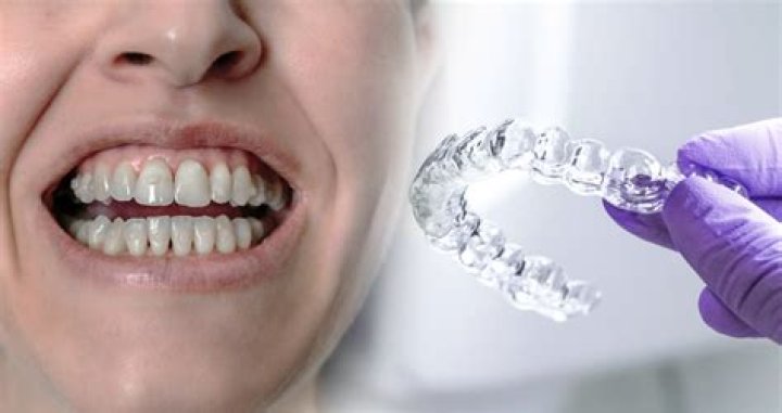 How do you sleep with Invisalign?