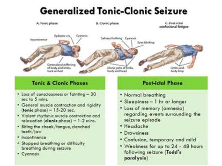 How do you spell Spasmatic?