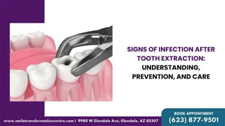 How do you stop infection after tooth extraction?