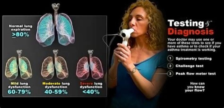 How do you test for Brunner syndrome?