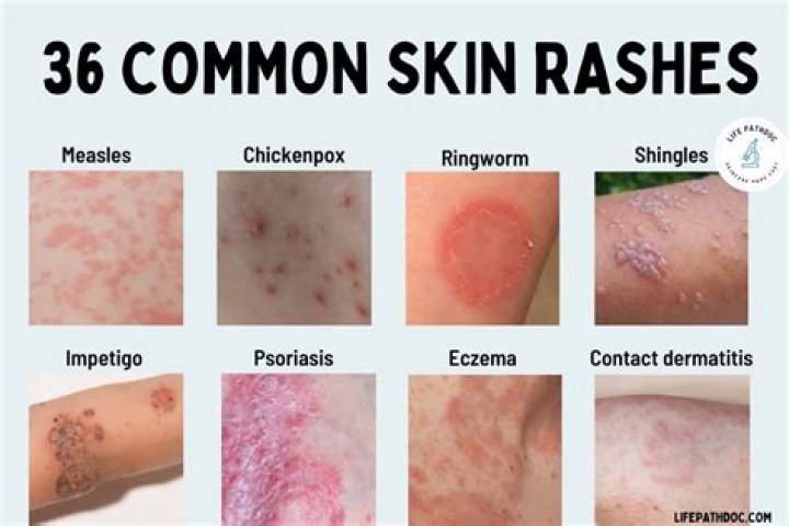 How does a skin rash look like?
