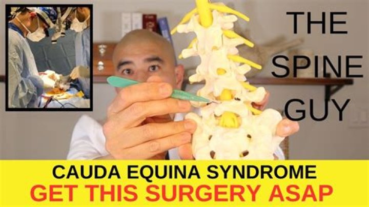 How long are you in hospital after cauda equina surgery?